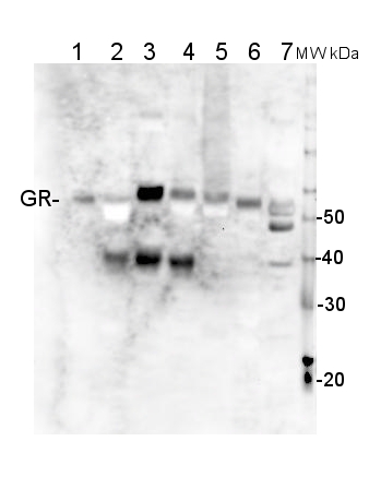 western blot using anti-GR antibodies 